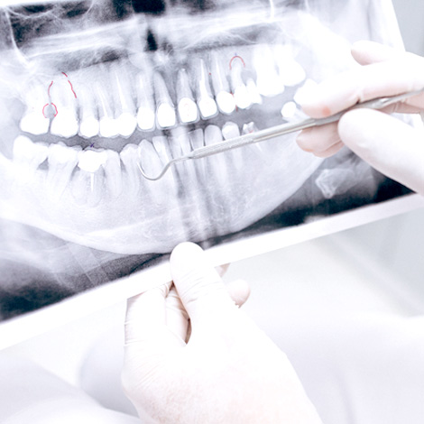 Centro Odontológico Alaia - Clínica Dental en Hernani - Dentistas en Hernani - Odontología general