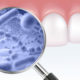 Centro Odontológico Alaia - Clínica Dental en Hernani - Dentistas en Hernani - microflora oral