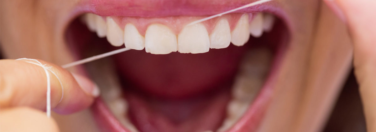 Centro Odontológico Alaia - Clínica Dental en Hernani - Dentistas en Hernani - hilo dental contra la placa bacteriana
